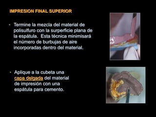 • Termine la mezcla del material de
polisulfuro con la surperficie plana de
la espátula. Esta técnica minimisará
el número de burbujas de aire
incorporadas dentro del material.
• Aplique a la cubeta una
capa delgada del material
de impresión con una
espátula para cemento.
IMPRESION FINAL SUPERIOR
 