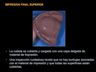 • La cubeta es cubierta y cargada con una capa delgada de
material de impresión.
• Una inspección cuidadosa revela que no hay burbujas asociadas
con el material de impresión y que todas las superficies están
cubiertas.
IMPRESION FINAL SUPERIOR
 