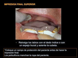 • Retraiga los labios con el dedo índice o con
un espejo bucal y asiente la cubeta.
*Coloque un campo de protección del paciente antes de hacer la
impresión final.
Los polisulfuros manchan la ropa del paciente.
IMPRESION FINAL SUPERIOR
 