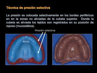 Técnica de presión selectiva
La presión es colocada selectivamente en los bordes periféricos
en en la zonas no aliviadas de la cubeta superior. Donde la
cubeta es aliviada los tejidos son registrados en su posición de
reposo (mucostática).
Alivio
Presión selectiva
 