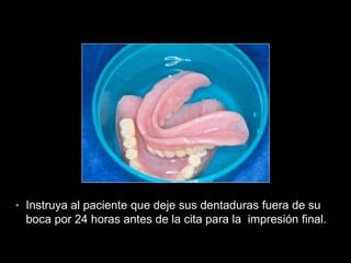 • Instruya al paciente que deje sus dentaduras fuera de su
boca por 24 horas antes de la cita para la impresión final.
 
