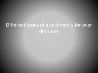 Different types of attachments for over
dentures
 