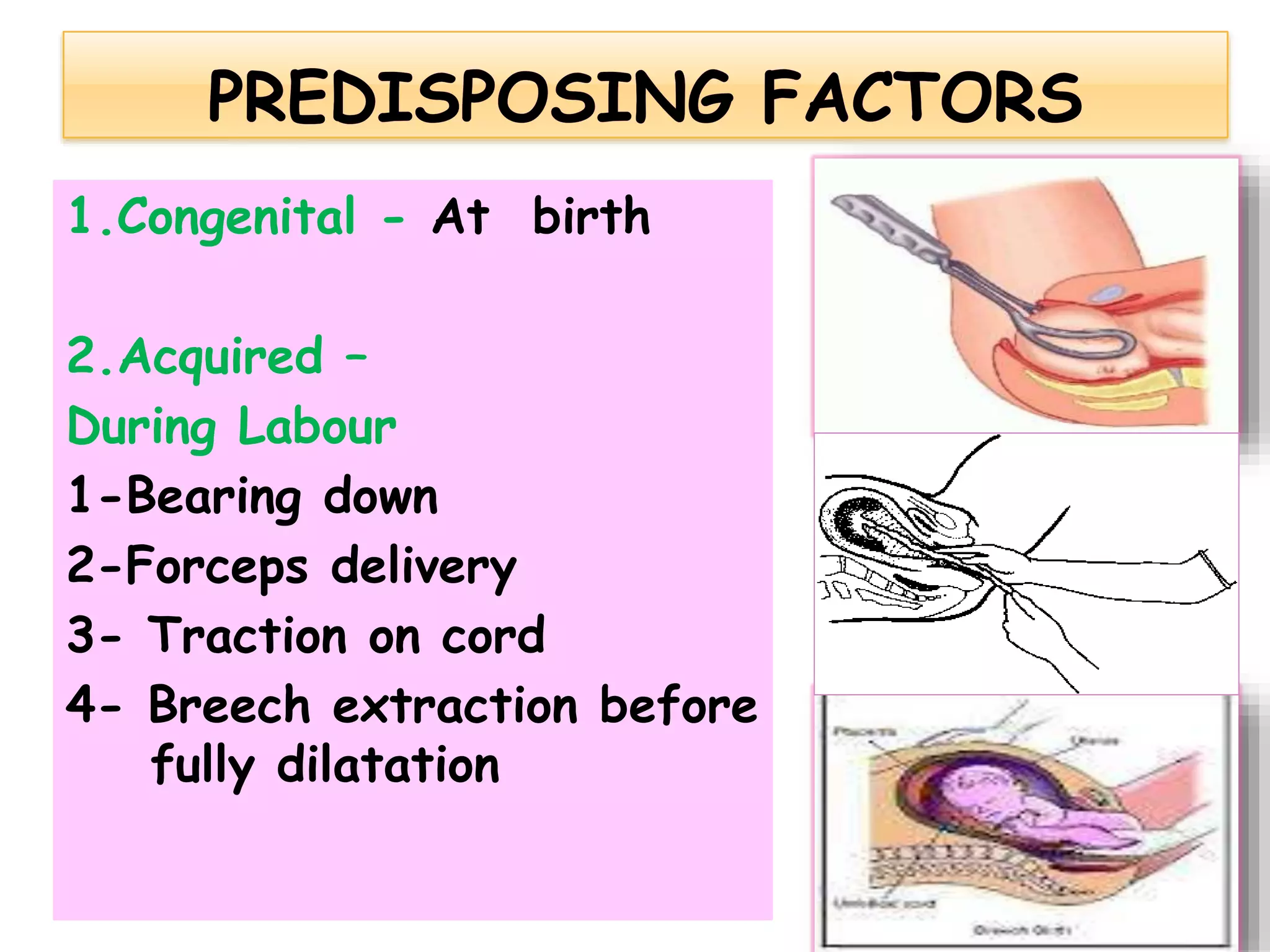 1.Congenital - At birth
2.Acquired –
During Labour
1-Bearing down
2-Forceps delivery
3- Traction on cord
4- Breech extraction before
fully dilatation
 