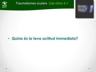 Traumatismes oculars Cas clínic 4.1




• Quina és la teva actitud immediata?
 
