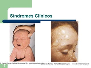 Síndromes Clínicos 