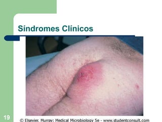 Síndromes Clínicos 