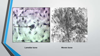 Woven boneLamellar bone
 