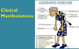 Clinical
Manifestations
12Prof. Dr. RS Mehta
 