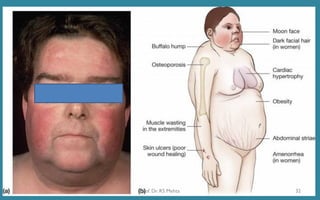 32Prof. Dr. RS Mehta
 