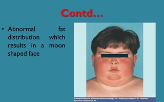 Contd…
• Abnormal fat
distribution which
results in a moon
shaped face
 