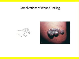 Complicationsof Wound Healing
 