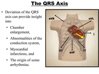 The QRS Axis
• Deviation of the QRS
axis can provide insight
into
• Chamber
enlargement,
• Abnormalities of the
conduction system,
• Myocardial
infarctions, and
• The origin of some
arrhythmias.
aVR aVL
I
III
aVF
II
 