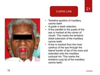 orientation jaw relation in complete denture fabrication | PPTX