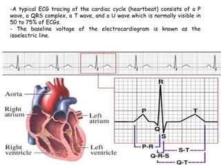 -A typical ECG tracing of the cardiac cycle (heartbeat) consists of a P
wave, a QRS complex, a T wave, and a U wave which is normally visible in
50 to 75% of ECGs.
- The baseline voltage of the electrocardiogram is known as the
isoelectric line.
 