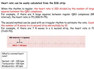 Heart rate can be easily calculated from the ECG strip:
When the rhythm is regular, the heart rate is 300 divided by the number of large
squares between the QRS complexes.
For example, if there are 4 large squares between regular QRS complexes (RR
interval), the heart rate is 75 (300/4=75).
The second method can be used with an irregular rhythm to estimate the rate. Count
the number of R waves in a 6 second strip and multiply by 10.
For example, if there are 7 R waves in a 6 second strip, the heart rate is 70
(7x10=70).
What’s a normal heart
rate?
Normal = 60 – 100 bpm
Tachycardia > 100 bpm
Bradycardia < 60 bpm
 