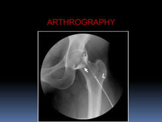 ARTHROGRAPHY
 