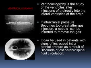 VENTRICULOGRAPHY
 Ventricuclogrphy is the study
of the ventricles after
injections of a directly into the
lateral ventricles of the brain.
 If intracranial pressure
Becomes too great after gas
injection, a needle can be
inserted to remove the gas
 It can be used in patients with
signs of increased intra
cranial presure as a result of
Blockade of csf cerebrospinal
fluid circulation.
 