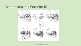 PROF.S.SUBBIAH et.al
Santamaria and Cordeiro IIIa
 