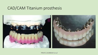 PROF.S.SUBBIAH et.al
CAD/CAM Titanium prosthesis
 