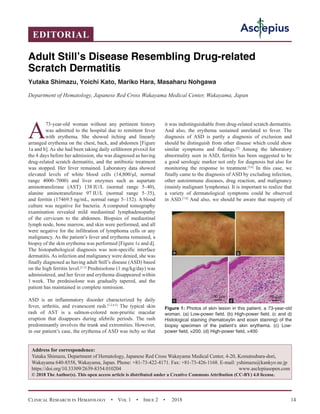 Clinical Research in Hematology  •  Vol 1  •  Issue 2  •  2018 14
A
73-year-old woman without any pertinent history
was admitted to the hospital due to remittent fever
with erythema. She showed itching and linearly
arranged erythema on the chest, back, and abdomen [Figure
1a and b]. As she had been taking daily cefditoren pivoxil for
the 4 days before her admission, she was diagnosed as having
drug-related scratch dermatitis, and the antibiotic treatment
was stopped. Her fever remained. Laboratory data showed
elevated levels of white blood cells (14,800/μl, normal
range 4000–7000) and liver enzymes such as aspartate
aminotransferase (AST) 138 IU/L (normal range 5–40),
alanine aminotransferase 97 IU/L (normal range 5–35),
and ferritin (17469.5 ng/mL, normal range 5–152). A blood
culture was negative for bacteria. A computed tomography
examination revealed mild mediastinal lymphadenopathy
of the cervicum to the abdomen. Biopsies of mediastinal
lymph node, bone marrow, and skin were performed, and all
were negative for the infiltration of lymphoma cells or any
malignancy. As the patient’s fever and erythema remained, a
biopsy of the skin erythema was performed [Figure 1c and d].
The histopathological diagnosis was non-specific interface
dermatitis.As infection and malignancy were denied, she was
finally diagnosed as having adult Still’s disease (ASD) based
on the high ferritin level.[1-3]
Prednisolone (1 mg/kg/day) was
administered, and her fever and erythema disappeared within
1 week. The prednisolone was gradually tapered, and the
patient has maintained in complete remission.
ASD is an inflammatory disorder characterized by daily
fever, arthritis, and evanescent rash.[1,2,4,5]
The typical skin
rash of AST is a salmon-colored non-pruritic macular
eruption that disappears during afebrile periods. The rash
predominantly involves the trunk and extremities. However,
in our patient’s case, the erythema of ASD was itchy so that
it was indistinguishable from drug-related scratch dermatitis.
And also, the erythema sustained unrelated to fever. The
diagnosis of ASD is partly a diagnosis of exclusion and
should be distinguish from other disease which could show
similar symptoms and findings.[2]
Among the laboratory
abnormality seen in ASD, ferritin has been suggested to be
a good serologic marker not only for diagnosis but also for
monitoring the response to treatment.[3,6]
In this case, we
finally came to the diagnosis of ASD by excluding infection,
other autoimmune diseases, drug reaction, and malignancy
(mainly malignant lymphoma). It is important to realize that
a variety of dermatological symptoms could be observed
in ASD.[7,8]
And also, we should be aware that majority of
Adult Still’s Disease Resembling Drug-related
Scratch Dermatitis
Yutaka Shimazu, Yoichi Kato, Mariko Hara, Masaharu Nohgawa
Department of Hematology, Japanese Red Cross Wakayama Medical Center, Wakayama, Japan
Address for correspondence:
Yutaka Shimazu, Department of Hematology, Japanese Red Cross Wakayama Medical Center, 4-20, Komatsubara-dori,
Wakayama 640-8558, Wakayama, Japan. Phone: +81-73-422-4171. Fax: +81-73-426-1168. E-mail: yshimazu@kankyo.ne.jp
https://doi.org/10.33309/2639-8354.010204 www.asclepiusopen.com
© 2018 The Author(s). This open access article is distributed under a Creative Commons Attribution (CC-BY) 4.0 license.
EDITORIAL
Figure 1: Photos of skin lesion in this patient, a 73-year-old
woman. (a) Low-power field. (b) High-power field. (c and d)
Histological staining (hematoxylin and eosin staining) of the
biopsy specimen of the patient’s skin erythema. (c) Low-
power field, ×200. (d) High-power field, ×400
d
c
b
a
 