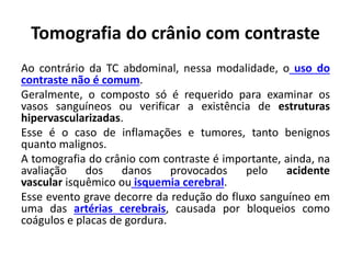 Tomografia do crânio com contraste
Ao contrário da TC abdominal, nessa modalidade, o uso do
contraste não é comum.
Geralmente, o composto só é requerido para examinar os
vasos sanguíneos ou verificar a existência de estruturas
hipervascularizadas.
Esse é o caso de inflamações e tumores, tanto benignos
quanto malignos.
A tomografia do crânio com contraste é importante, ainda, na
avaliação dos danos provocados pelo acidente
vascular isquêmico ou isquemia cerebral.
Esse evento grave decorre da redução do fluxo sanguíneo em
uma das artérias cerebrais, causada por bloqueios como
coágulos e placas de gordura.
 