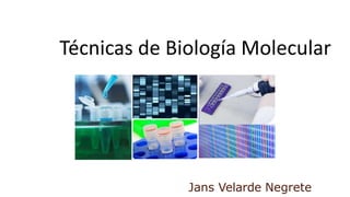 Jans Velarde Negrete
Técnicas de Biología Molecular
 