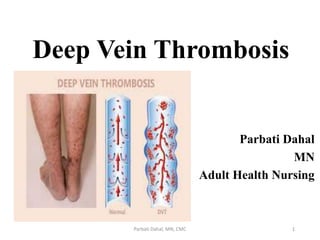 Deep Vein Thrombosis
Parbati Dahal
MN
Adult Health Nursing
1
Parbati Dahal, MN, CMC
 