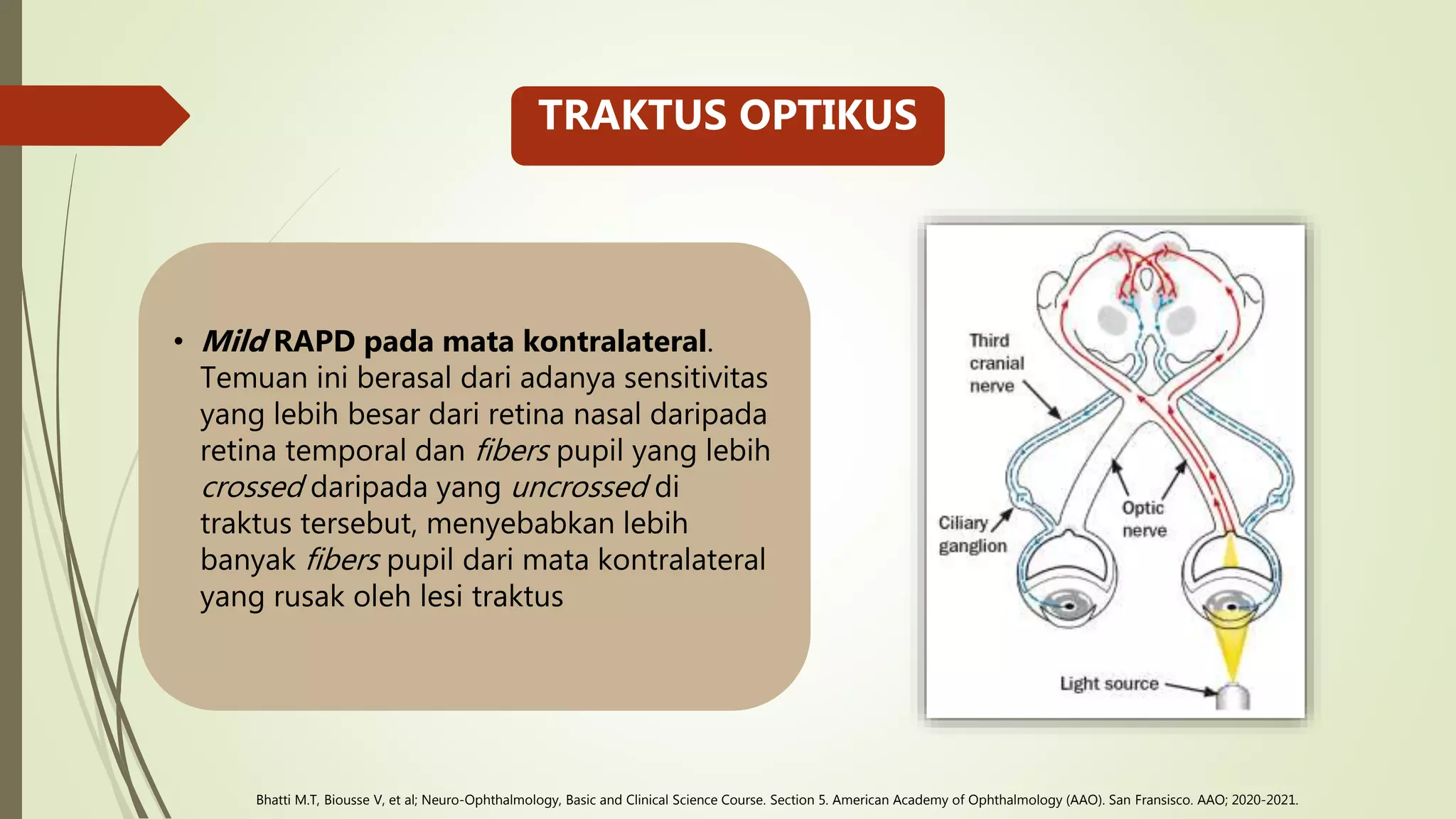 4. Retrochiasmal Lesion.pptx