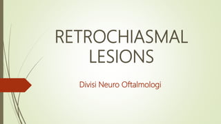RETROCHIASMAL
LESIONS
Divisi Neuro Oftalmologi
 