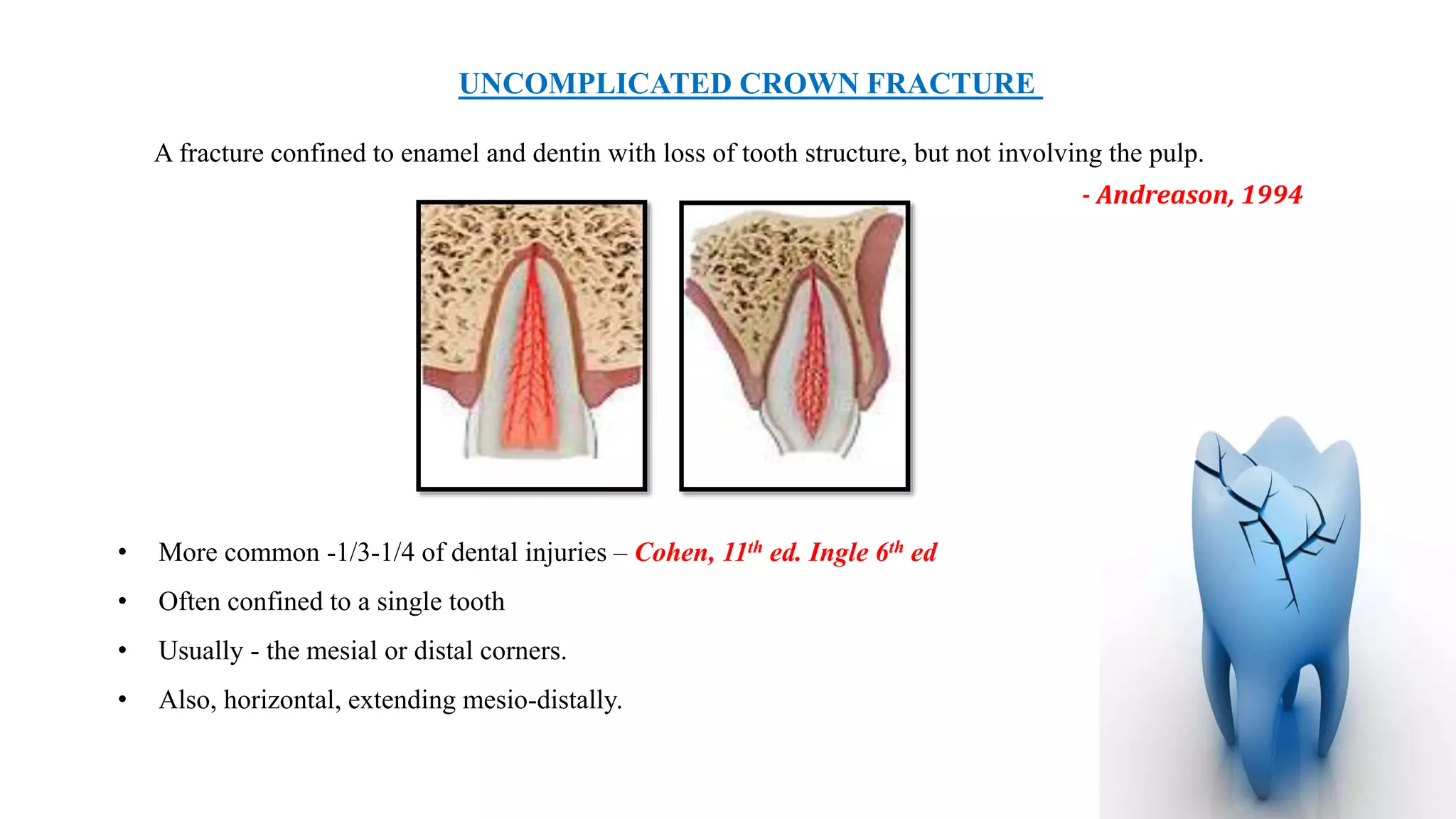 Enamel Infarctions DENTAL TRAUMATIC INJURIES | PPTX
