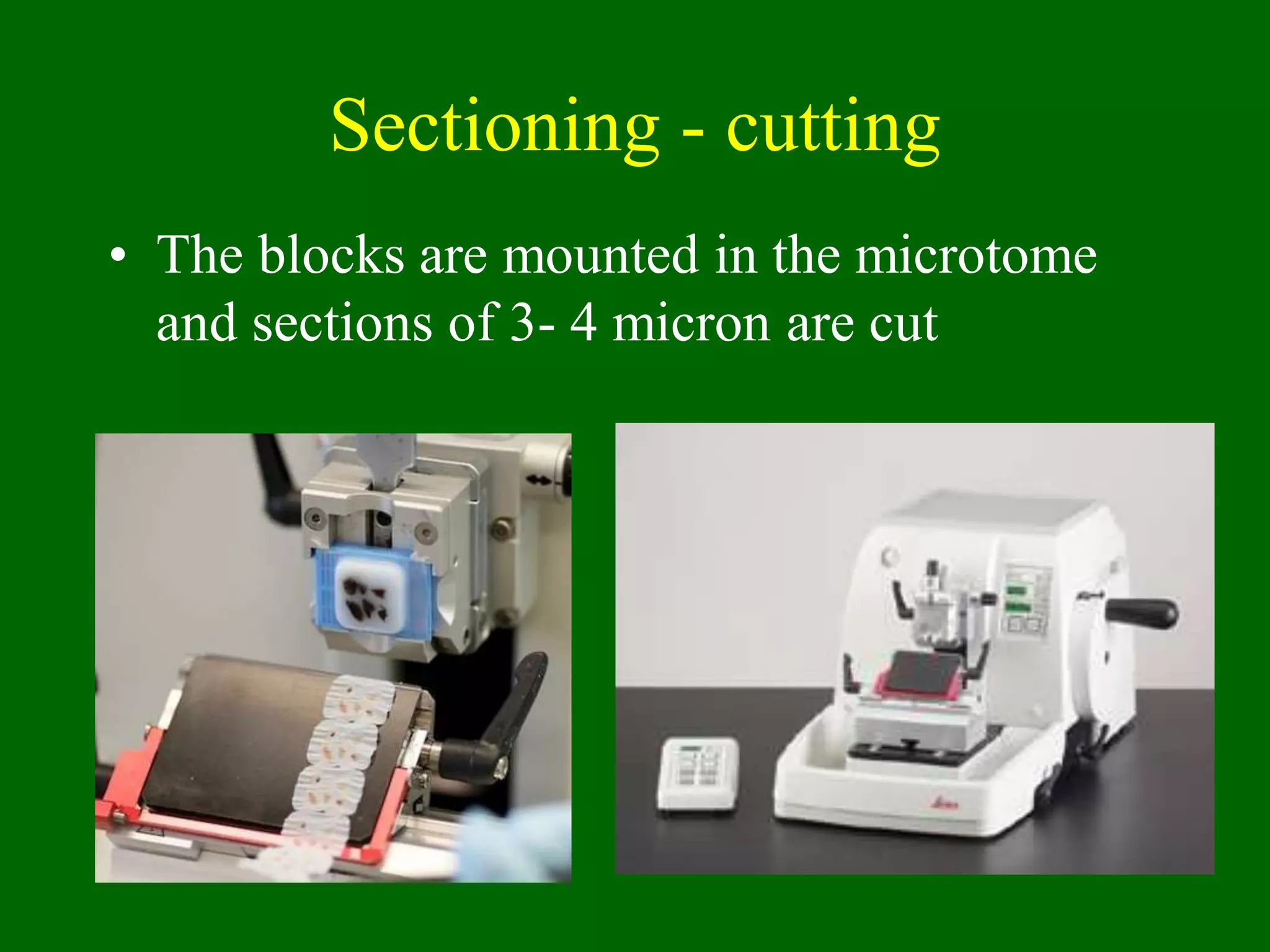 Sectioning - cutting
• The blocks are mounted in the microtome
and sections of 3- 4 micron are cut
 