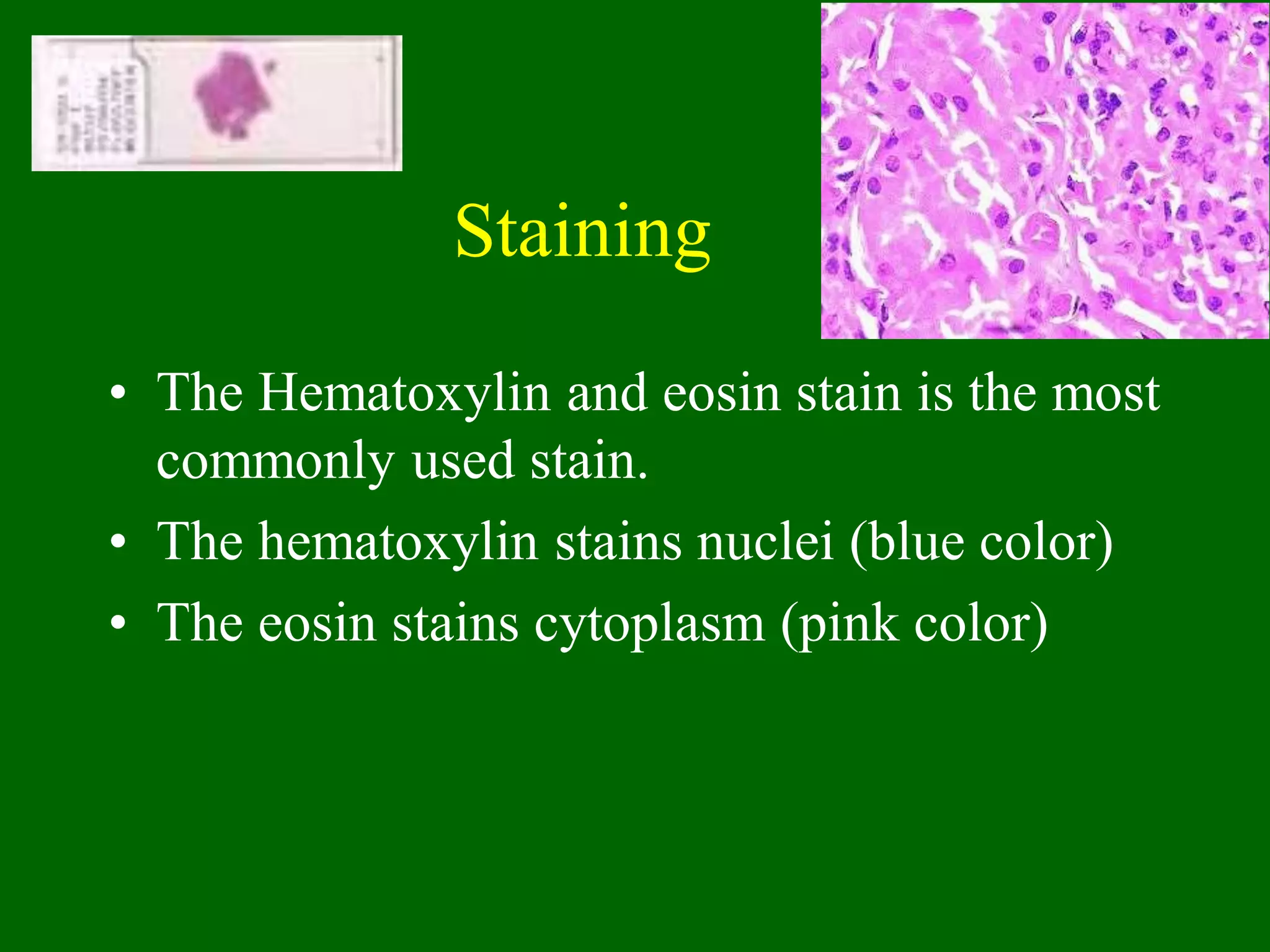 Staining
• The Hematoxylin and eosin stain is the most
commonly used stain.
• The hematoxylin stains nuclei (blue color)
• The eosin stains cytoplasm (pink color)
 