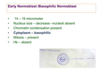 Early Normoblast /Basophilic Normoblast
• 14 – 16 micrometer
• Nucleus size – decrease –nucleoli absent
• Chromatin condensation present
• Cytoplasm – basophilic
• Mitosis – present
• Hb – absent
 