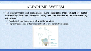 ALFAPUMP SYSTEM
➢ The programmable and rechargeable pump transports small amount of ascites
continuously from the peritoneal cavity into the bladder to be eliminated by
micturition.
➢ Good result in management of refractory ascites.
➢ Higher frequencies of technical difficulties and renal dysfunction.
 