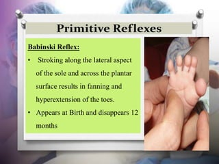 Babinski Reflex:
• Stroking along the lateral aspect
of the sole and across the plantar
surface results in fanning and
hyp...