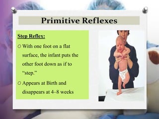 Step Reflex:
O With one foot on a flat
surface, the infant puts the
other foot down as if to
“step.”
O Appears at Birth an...