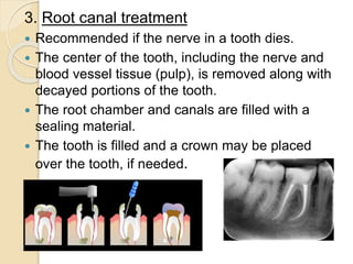 4.DISEASE OF HARD TISSUES OF TEETH.pptx