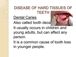 4.DISEASE OF HARD TISSUES OF TEETH.pptx