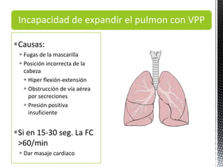 Incapacidad de expandir el pulmon con VPP
Causas:
 Fugas de la mascarilla
 Posición incorrecta de la
cabeza
 Hiper flexión-extensión
 Obstrucción de vía aérea
por secreciones
 Presión positiva
insuficiente
Si en 15-30 seg. La FC
>60/min
 Dar masaje cardiaco
 