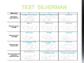 TEST SILVERMAN
 