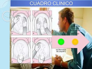 CUADRO CLINICO
Previo al
ingreso de una
paciente a la
Sala de
Trabajo de
Parto o Labor,
que sea
candidata a
estar en ese
lugar por no
tener factores
de riesgo
descontrolado,
y se encuentre
con un
embarazo de
termino se
deberán
practicar una
evaluación
adecuada de la
pacientes que
incluyan:
las Maniobras
de Leopold y
exploración
vaginal en
forma manual
para
determinar:
 