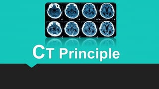 CT Principle
 