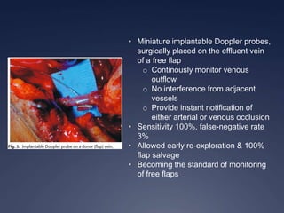 • Miniature implantable Doppler probes,
surgically placed on the effluent vein
of a free flap
o Continously monitor venous
outflow
o No interference from adjacent
vessels
o Provide instant notification of
either arterial or venous occlusion
• Sensitivity 100%, false-negative rate
3%
• Allowed early re-exploration & 100%
flap salvage
• Becoming the standard of monitoring
of free flaps
 