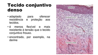 Tecido conjuntivo
denso
• adaptado para oferecer
resistência e proteção aos
tecidos.
• é menos flexível e mais
resistente à tensão que o tecido
conjuntivo frouxo.
• encontrado, por exemplo, na
derme
 