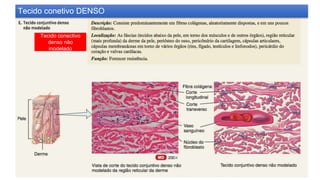 Tecido conectivo
denso não
modelado
Tecido conetivo DENSO
 