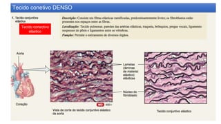 Tecido conectivo
elástico
Tecido conetivo DENSO
 