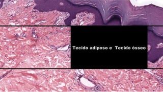 Tecido adiposo e Tecido ósseo
 