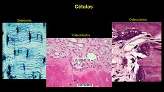 Osteócitos
Osteoblastos
Osteoclastos
Células
 