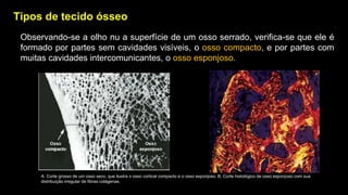 Tipos de tecido ósseo
Observando-se a olho nu a superfície de um osso serrado, verifica-se que ele é
formado por partes sem cavidades visíveis, o osso compacto, e por partes com
muitas cavidades intercomunicantes, o osso esponjoso.
A. Corte grosso de um osso seco, que ilustra o osso cortical compacto e o osso esponjoso. B. Corte histológico de osso esponjoso com sua
distribuição irregular de fibras colágenas.
 