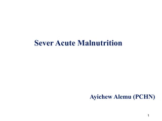 Sever Acute Malnutrition
Ayichew Alemu (PCHN)
1
 